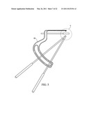 METHOD FOR TREATING JOINT PAIN AND ASSOCIATED INSTRUMENTS diagram and image