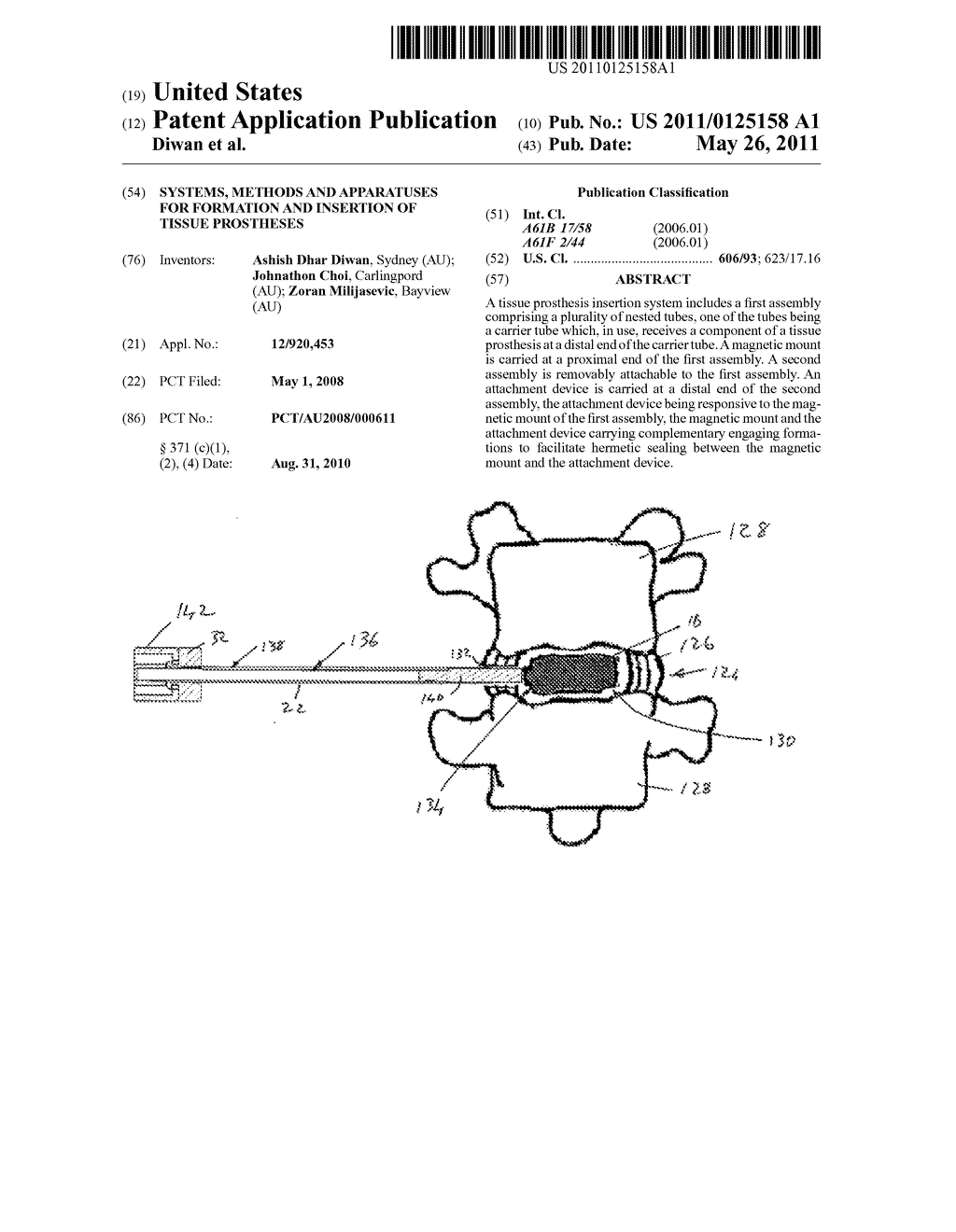 SYSTEMS, METHODS AND APPARATUSES FOR FORMATION AND INSERTION OF TISSUE PROSTHESES - diagram, schematic, and image 01