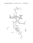 ULTRASOUND CATHETER DEVICES AND METHODS diagram and image