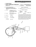 SYSTEM AND METHOD FOR MACRO-MICRO DISTAL DEXTERITY ENHANCEMENT IN MICRO-SURGERY OF THE EYE diagram and image