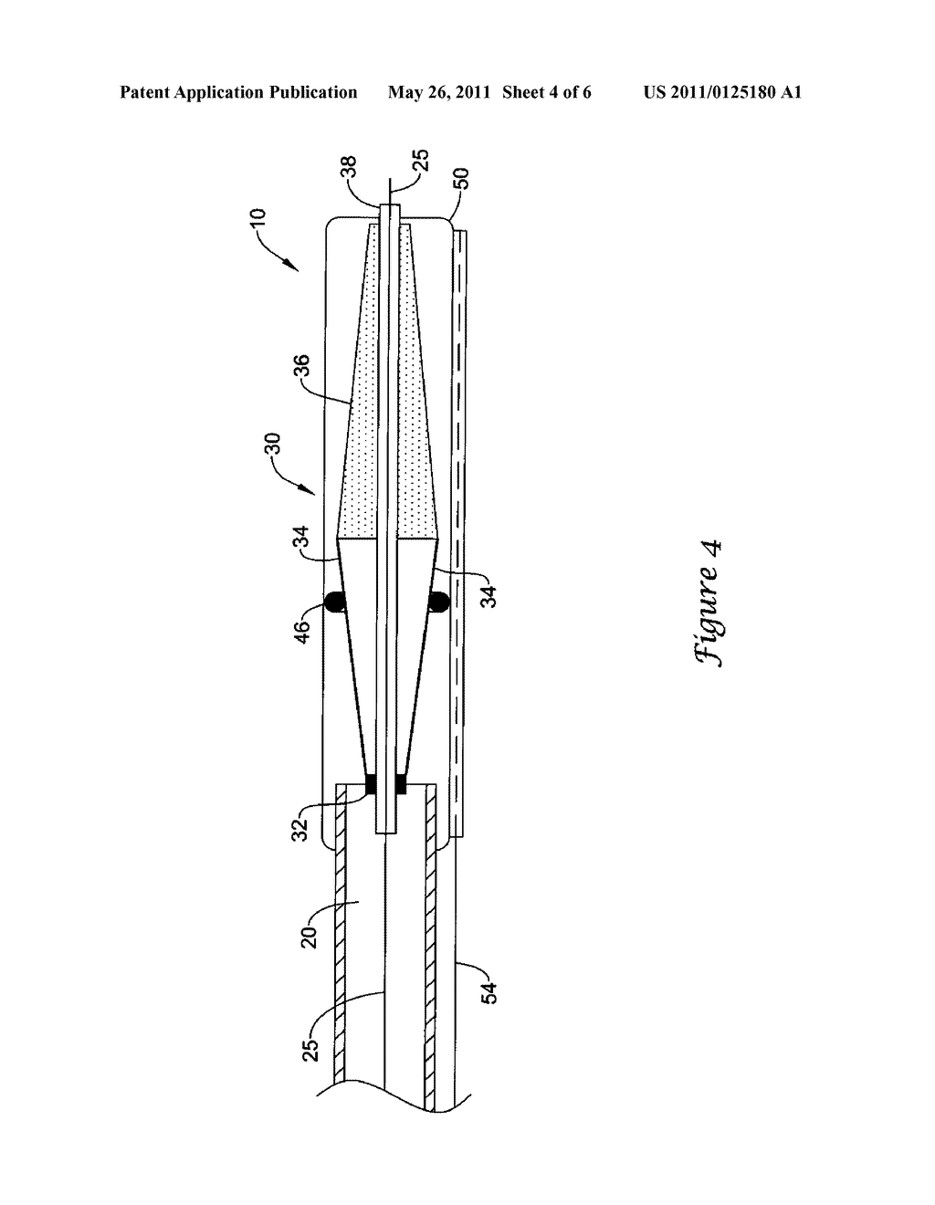 EMBOLIC PROTECTION DEVICE - diagram, schematic, and image 05