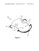 Intraoral acupressure apparatus diagram and image