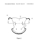 Intraoral acupressure apparatus diagram and image