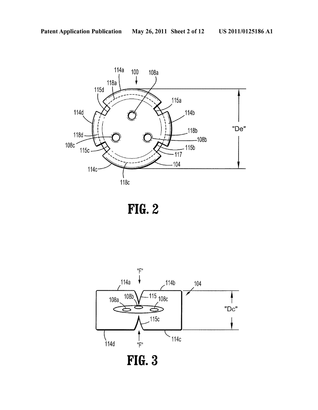 FOAM INTRODUCTION SYSTEM INCLUDING MODIFIED PORT GEOMETRY - diagram, schematic, and image 03