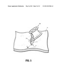 FOAM INTRODUCTION SYSTEM INCLUDING MODIFIED PORT GEOMETRY diagram and image