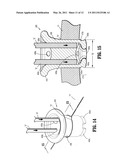 FOAM INTRODUCTION SYSTEM INCLUDING MODIFIED PORT GEOMETRY diagram and image