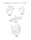 CAM Lock Pedicle Screw diagram and image