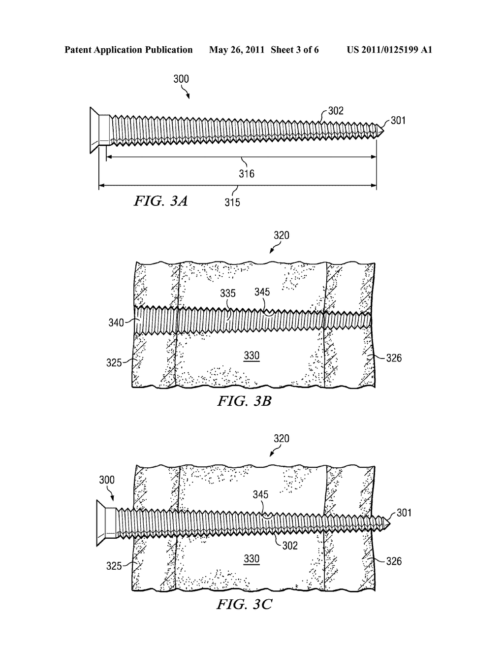 Tapered Threaded Orthopedic Fastener Engaging Predetermined Radial Preloads - diagram, schematic, and image 04