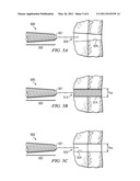 Tapered Threaded Orthopedic Fastener Engaging Predetermined Radial Preloads diagram and image
