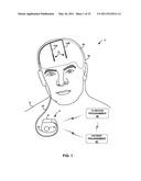 MEDICAL ELECTRICAL STIMULATION WITH EXTERNAL SIMULATED CASE ELECTRODE diagram and image