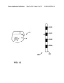 MEDICAL ELECTRICAL STIMULATION WITH EXTERNAL SIMULATED CASE ELECTRODE diagram and image