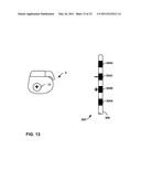 MEDICAL ELECTRICAL STIMULATION WITH EXTERNAL SIMULATED CASE ELECTRODE diagram and image