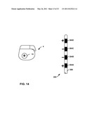 MEDICAL ELECTRICAL STIMULATION WITH EXTERNAL SIMULATED CASE ELECTRODE diagram and image