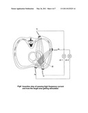 INTERFERENTIAL NON INVASIV TEMPORARY PACER diagram and image