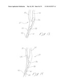 INDWELLING HEAT EXCHANGE CATHETER AND METHOD OF USING SAME diagram and image