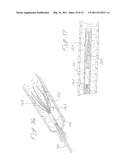 INDWELLING HEAT EXCHANGE CATHETER AND METHOD OF USING SAME diagram and image