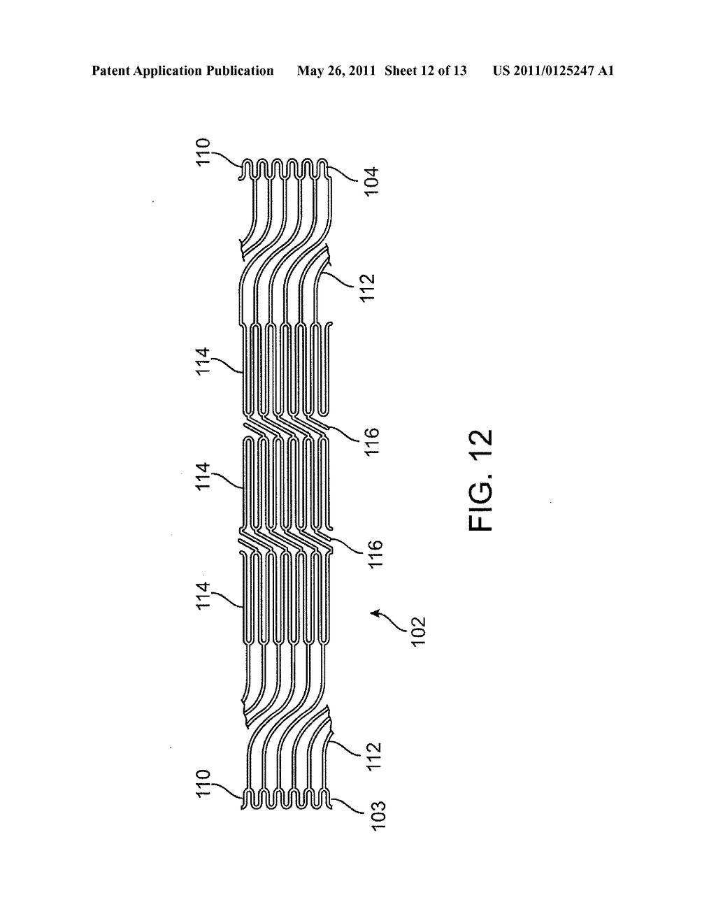 BALLOON CATHETER WITH NON-DEPLOYABLE STENT - diagram, schematic, and image 13