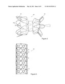 Stent Graft and Introducer Assembly diagram and image