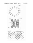 Stent and Method for Manufacturing the Same diagram and image