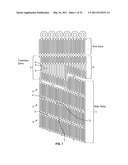 Self-Expanding Stent with Polygon Transition Zone diagram and image