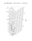 Self-Expanding Stent with Polygon Transition Zone diagram and image