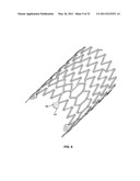 Self-Expanding Stent with Polygon Transition Zone diagram and image