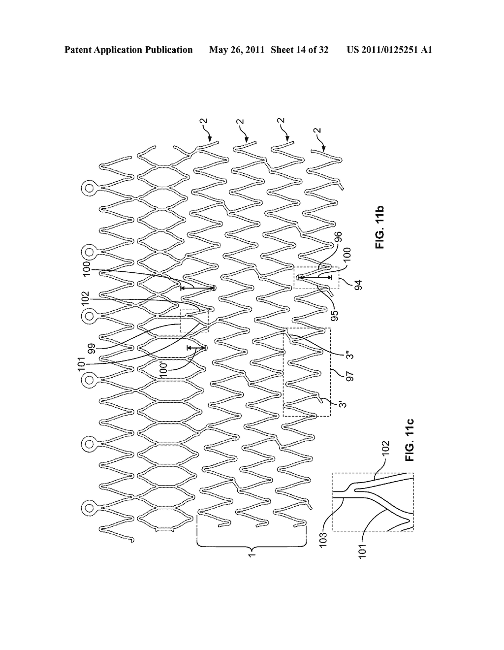 Self-Expanding Stent with Polygon Transition Zone - diagram, schematic, and image 15