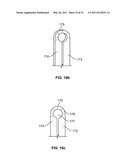 Self-Expanding Stent with Polygon Transition Zone diagram and image