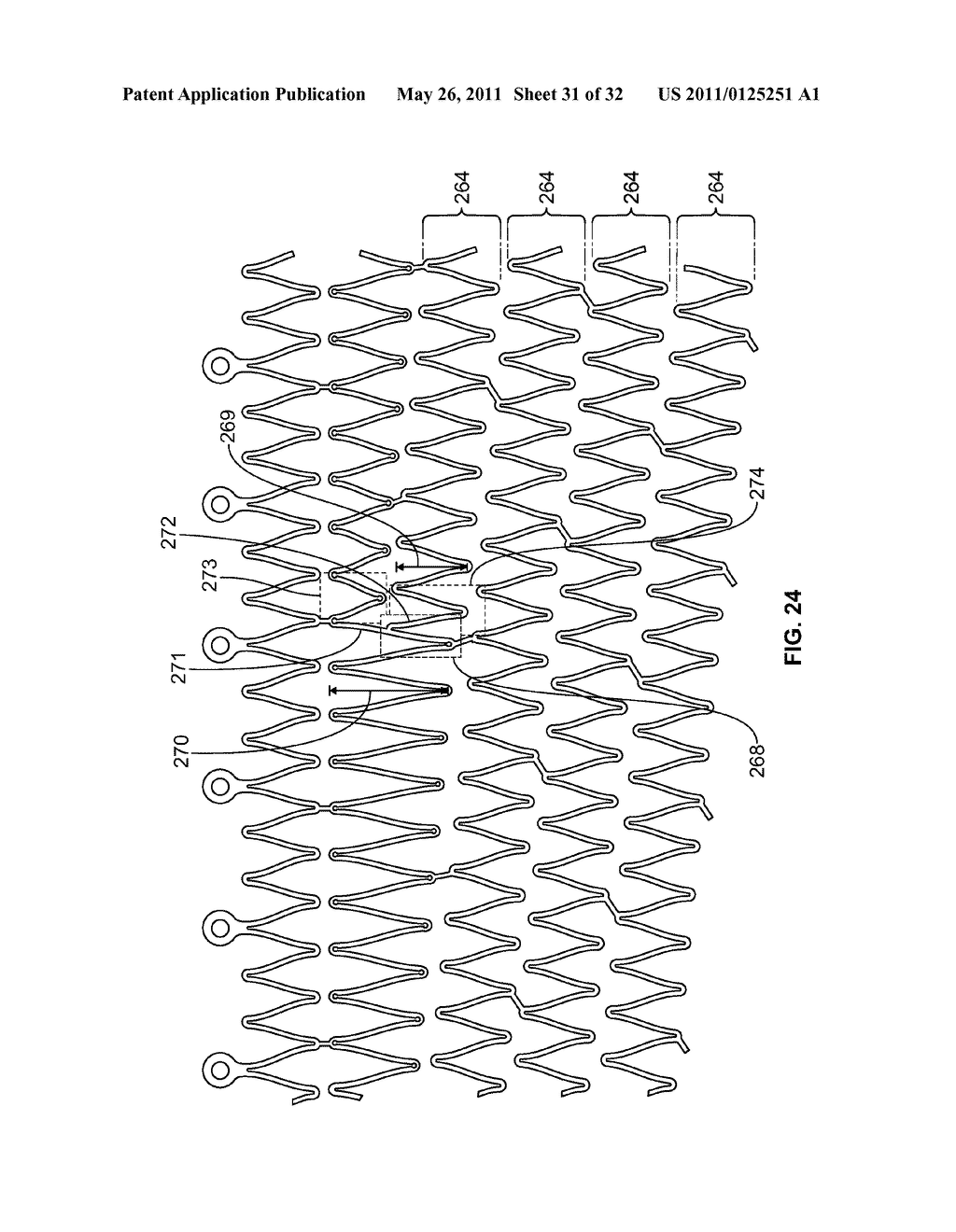 Self-Expanding Stent with Polygon Transition Zone - diagram, schematic, and image 32