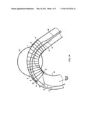 SYSTEM AND METHOD FOR POSITIONING A STENT GRAFT diagram and image