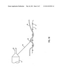 SYSTEM AND METHOD FOR POSITIONING A STENT GRAFT diagram and image