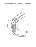 SYSTEM AND METHOD FOR POSITIONING A STENT GRAFT diagram and image