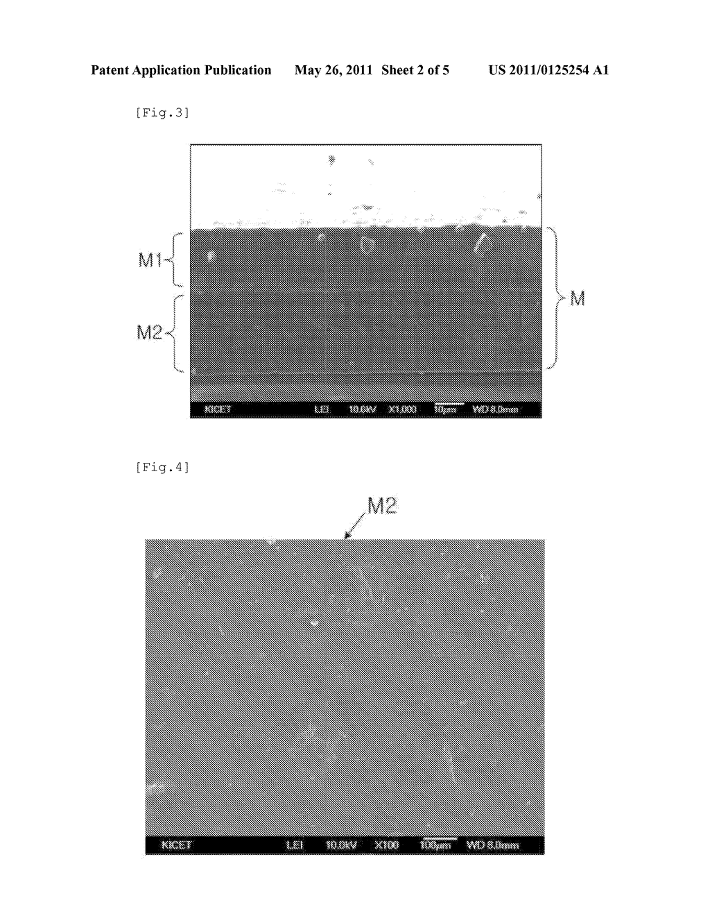 DRUG RELEASING MEMBRANE FOR STENT AND DRUG RELEASING STENT FOR EXPANDING INTRALUMINAL COMPRISING THE SAME - diagram, schematic, and image 03