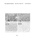 METHOD FOR PRODUCING NANOSTRUCTURES ON A SURFACE OF A MEDICAL IMPLANT diagram and image