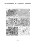 METHOD FOR PRODUCING NANOSTRUCTURES ON A SURFACE OF A MEDICAL IMPLANT diagram and image