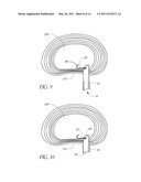 METHOD OF PERFORMING AN ANCHOR IMPLANTATION PROCEDURE WITHIN A DISC diagram and image