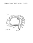 METHOD OF PERFORMING AN ANCHOR IMPLANTATION PROCEDURE WITHIN A DISC diagram and image