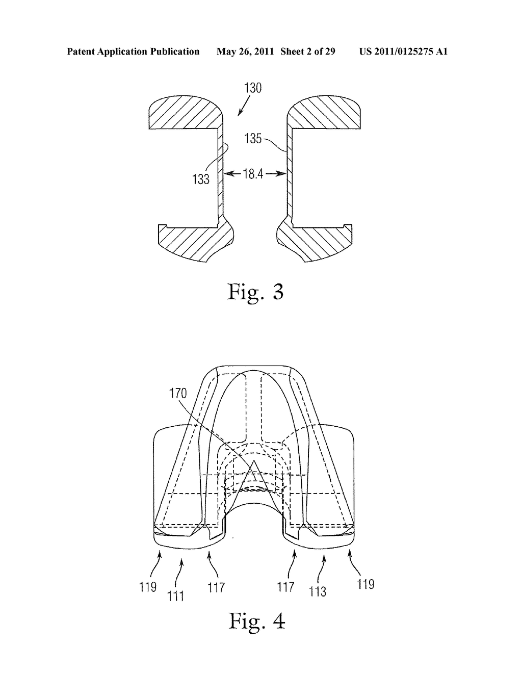 PROSTHETIC CONDYLAR JOINTS WITH ARTICULATING BEARING SURFACES HAVING A TRANSLATING CONTACT POINT DURING ROTATION THEREOF - diagram, schematic, and image 03