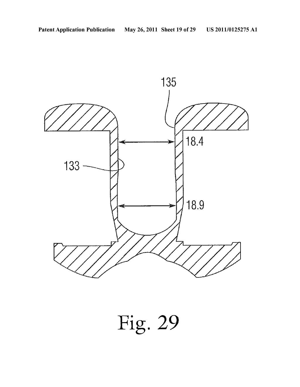 PROSTHETIC CONDYLAR JOINTS WITH ARTICULATING BEARING SURFACES HAVING A TRANSLATING CONTACT POINT DURING ROTATION THEREOF - diagram, schematic, and image 20