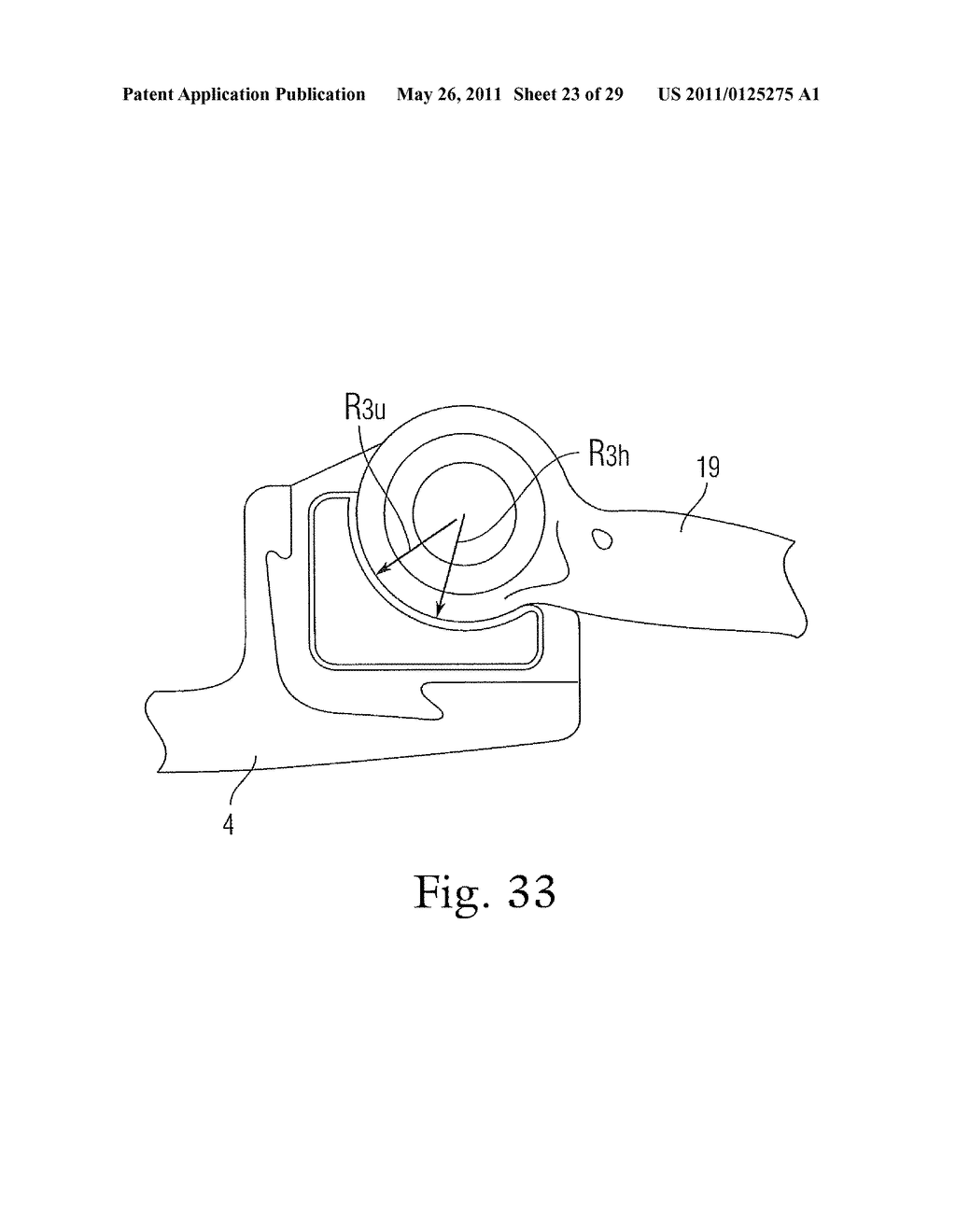 PROSTHETIC CONDYLAR JOINTS WITH ARTICULATING BEARING SURFACES HAVING A TRANSLATING CONTACT POINT DURING ROTATION THEREOF - diagram, schematic, and image 24