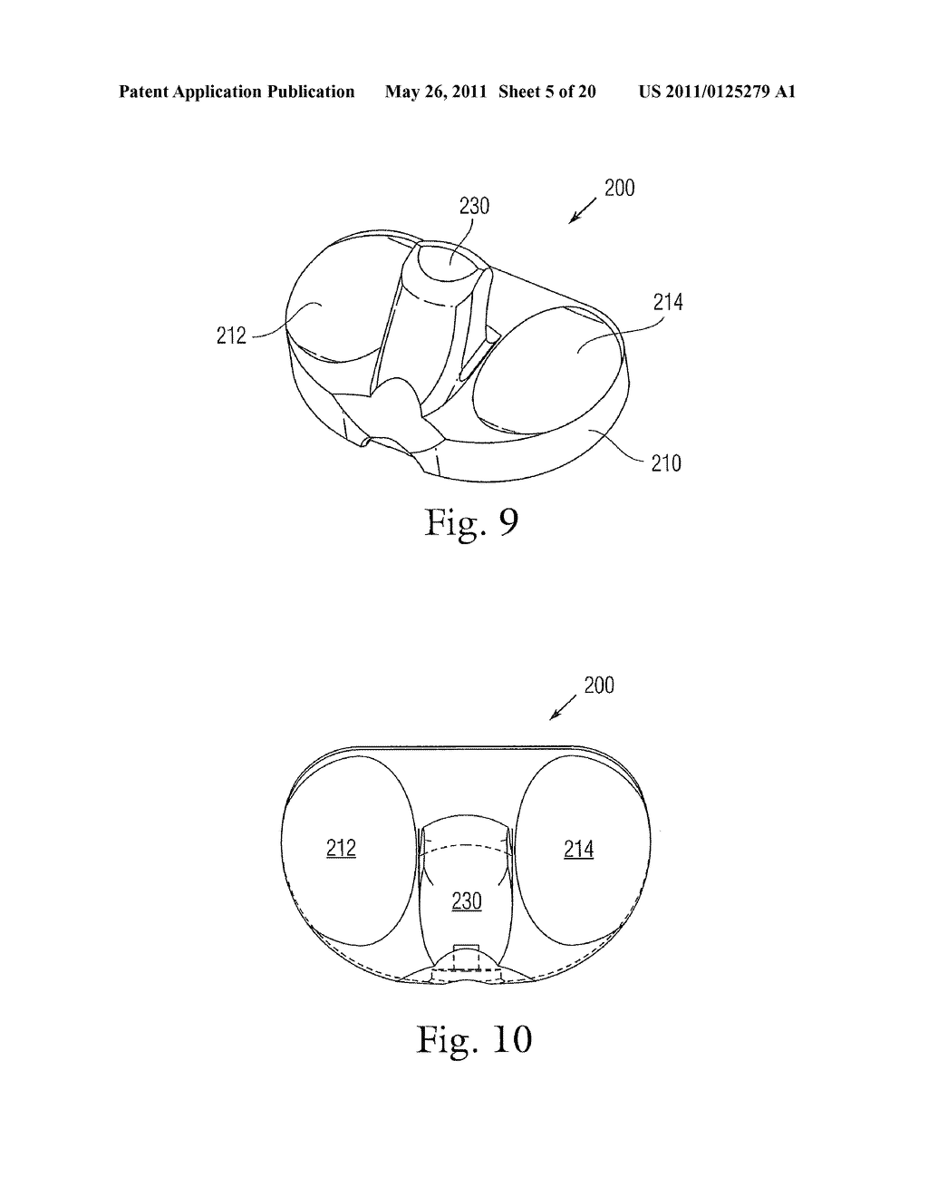 CONSTRAINED CONDYLAR KNEE DEVICE - diagram, schematic, and image 06