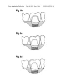 METHOD FOR AUTOMATICALLY FABRICATING A DENTAL SUPERSTRUCTURE FOR ATTACHMENT TO AN IMPLANT diagram and image