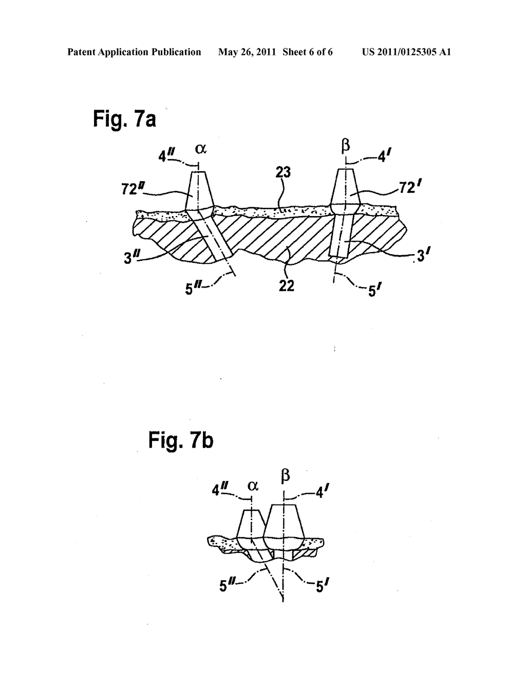 METHOD FOR AUTOMATICALLY FABRICATING A DENTAL SUPERSTRUCTURE FOR ATTACHMENT TO AN IMPLANT - diagram, schematic, and image 07