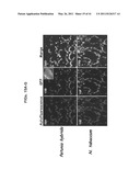 PLANT VIRAL EXPRESSION VECTORS AND USE OF SAME FOR GENERATING GENOTYPIC VARIATIONS IN PLANT GENOMES diagram and image