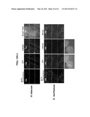 PLANT VIRAL EXPRESSION VECTORS AND USE OF SAME FOR GENERATING GENOTYPIC VARIATIONS IN PLANT GENOMES diagram and image