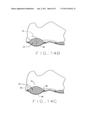 SHOE SOLE WITH COMPRESSIBLE PROTRUDING ELEMENT diagram and image