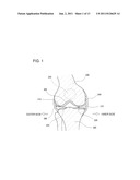 KNEE ACOUSTIC MATCHING DEVICE FOR ULTRASONIC PROBE diagram and image