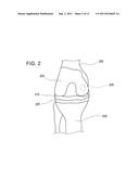 KNEE ACOUSTIC MATCHING DEVICE FOR ULTRASONIC PROBE diagram and image