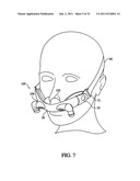 PATIENT INTERFACE DEVICE diagram and image