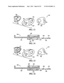 PATIENT INTERFACE DEVICE diagram and image